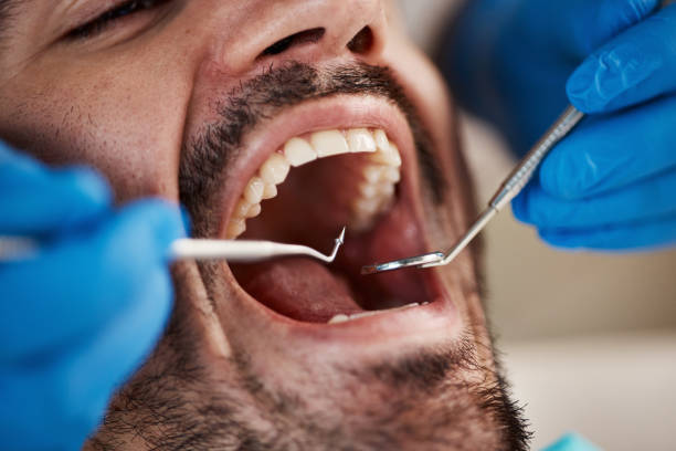 Best Emergency Broken Tooth Repair in Mequon, WI